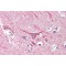E3 Ubiquitin-Protein Ligase UBR2 (UBR2) Antibody
