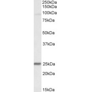 abx431719 (0.1 µg/ml) staining of Mouse Heart lysate (35 µg protein in RIPA buffer). Primary incubation was 1 hour. Detected by chemiluminescence.