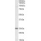NADH:Ubiquinone Oxidoreductase Core Subunit S8 (NDUFS8) Antibody