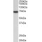 Tyrosine-Protein Kinase ZAP-70 (ZAP70) Antibody