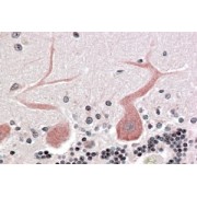 abx431727 (3.8 µg/ml staining of paraffin embedded Human Cerebellum Steamed antigen retrieval with citrate buffer pH 6, AP-staining.