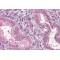 CTD Small Phosphatase Like Protein 1 (CTDSP1) Antibody