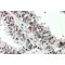 Zinc Finger Protein ZIC 3 (ZIC3) Antibody