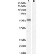 abx431740 (1 µg/ml) staining of Mouse Heart lysate (35 µg protein in RIPA buffer). Detected by chemiluminescence.