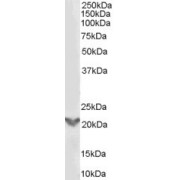 abx431744 (0.3 µg/ml) staining of A431 lysate (35 µg protein in RIPA buffer). Primary incubation was 1 hour. Detected by chemiluminescence.