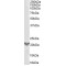 TGFB Induced Factor Homeobox 2 (TGIF2) Antibody