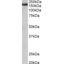 Terminal Uridylyltransferase 4 (TUT4) Antibody