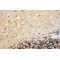 Cytochrome P450 26B1 (CYP26B1) Antibody
