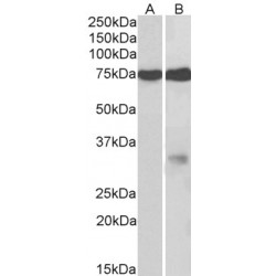 Neuronal Membrane Glycoprotein M6-A (GPM6A) Antibody