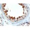 Alstrom Syndrome Protein 1 (ALMS1) Antibody