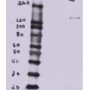 MDCK overexpressing Mouse Btbd7 (third lane) and probed with abx431779 (mock transfection in first lane, full construct chemically suppressed in second lane).