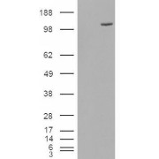 HEK293 overexpressing FAM62A and probed with abx431789 (mock transfection in first lane).