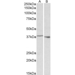 Poly(RC) Binding Protein 1 (PCBP1) Antibody
