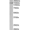 Synaptic Ras GTPase Activating Protein 1 (SYNGAP1) Antibody
