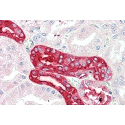RING-Type E3 Ubiquitin Transferase MEX3C (MEX3C) Antibody