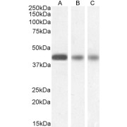 Western blot analysis of Human Cerebellum  (A), Mouse (B) and Rat (C) Brain lysate (35 µg protein in RIPA buffer) using SEPTIN3 antibody (Human: 0.5 µg/ml, Mouse: 0.1 µg/ml, Rat: 0.03 µg/ml).