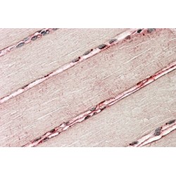 Delta-Sarcoglycan Antibody