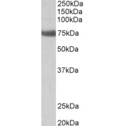 abx431807 (2 µg/ml) staining of Rat Lung lysate (35 µg protein in RIPA buffer). Primary incubation was 1 hour. Detected by chemiluminescence.