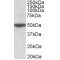 Muscarinic Acetylcholine Receptor M2 (CHRM2) Antibody