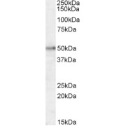 WB analysis of Human Brain (Hippocampus) lysate using Orexin Receptor 2 (HCRTR2) Antibody (1.5 µg/ml).
