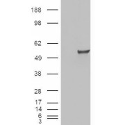 HEK293 overexpressing ESRRG and probed with abx431836 (mock transfection in first lane).