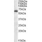 Fat Mass And Obesity-Associated (FTO) Antibody