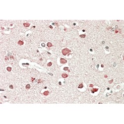 Neurobeachin (NBEA) Antibody