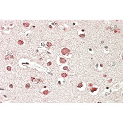 Neurobeachin (NBEA) Antibody