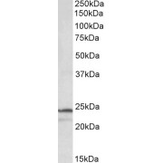 abx431842 (1 µg/ml) staining of K562 lysate (35 µg protein in RIPA buffer). Primary incubation was 1 hour. Detected by chemiluminescence.