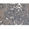Receptor Tyrosine Kinase Like Orphan Receptor 1 (ROR1) Antibody