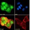 Chromodomain Helicase DNA Binding Protein 5 (CHD5) Antibody