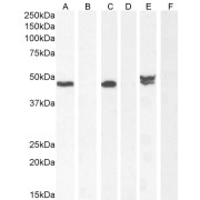 Western blot analysis of Human Cerebellum (A), Human Cerebellum blocked with peptide (B), Mouse Brain (C), Mouse brain blocked with peptide (D), Rat Brain (E), and Rat brain blocked with peptide (F) samples (35 µg protein in RIPA buffer), using N-Acetylaspartate Synthetase (Nat8l) Antibody (0.1 µg/ml).