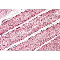 Isocitrate Dehydrogenase 2, Mitochondrial (IDH2) Antibody