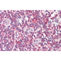 Monofunctional C1-Tetrahydrofolate Synthase, Mitochondrial (MTHFD1L) Antibody
