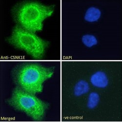 Casein Kinase I Isoform Epsilon (CSNK1E) Antibody