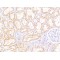 Multidrug Resistance-Associated Protein 5 (MRP5) Antibody