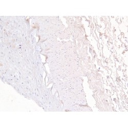 Multidrug Resistance-Associated Protein 5 (MRP5) Antibody