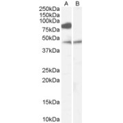 abx431878 (0.1 µg/ml) staining of Human Brain (Frontal Cortex) lysate (35 µg protein in RIPA buffer) with (B) and without (A) blocking with the immunising peptide. Primary incubation was 1 hour. Detected by chemiluminescence.