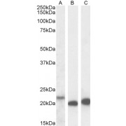 Western blot analysis of extracts of HeLa (A), A431 (B) and US0S (C) cell lysate (35 µg protein in RIPA buffer) using IL18 antibody ((A): 0.1 µg/ml, (B and C): 2 µg/ml).