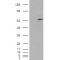 Insulin Like Growth Factor 2 mRNA Binding Protein 2 (IGF2BP2) Antibody