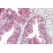 Kinesin-Like Protein KIF6 (KIF6) Antibody