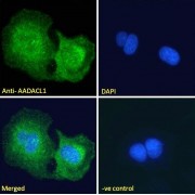 abx431923 Immunofluorescence analysis of paraformaldehyde fixed A431 cells, permeabilized with 0.15% Triton. Primary incubation 1hr (10 µg/ml) followed by AF488 secondary antibody (2 µg/ml), showing Endoplasmic reticulum staining. The nuclear stain is DAPI (blue). Negative control: Unimmunized goat IgG (10 µg/ml) followed by AF488 secondary antibody (2 µg/ml).
