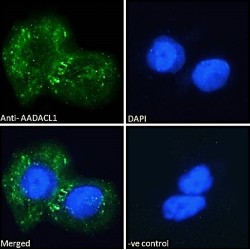 Arylacetamide Deacetylase-Like 1 (AADACL1) Antibody