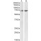 E3 Ubiquitin-Protein Ligase Synoviolin (SYVN1) Antibody