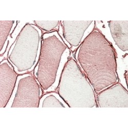 Tripartite Motif-Containing Protein 72 (TRIM72) Antibody