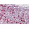 Prothymosin Alpha (PTMA) Antibody