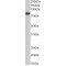 Coilin (COIL) Antibody