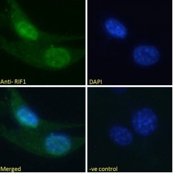 Telomere-Associated Protein RIF1 (RIF1) Antibody