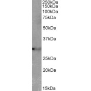 abx431963 (2 µg/ml) staining of Mouse Lung lysate (35 µg protein in RIPA buffer). Primary incubation was 1 hour. Detected by chemiluminescence.
