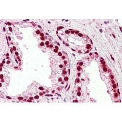 Interferon Regulatory Factor 6 (IRF6) Antibody